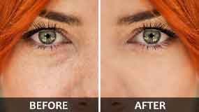 Portrait Retouch With Healing Brush Tool And Spot Healing Brush Tool Photoshop
